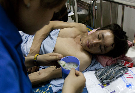 Công nhân TQ bị đánh thương ở Vũng Áng được chăm sóc tận tình